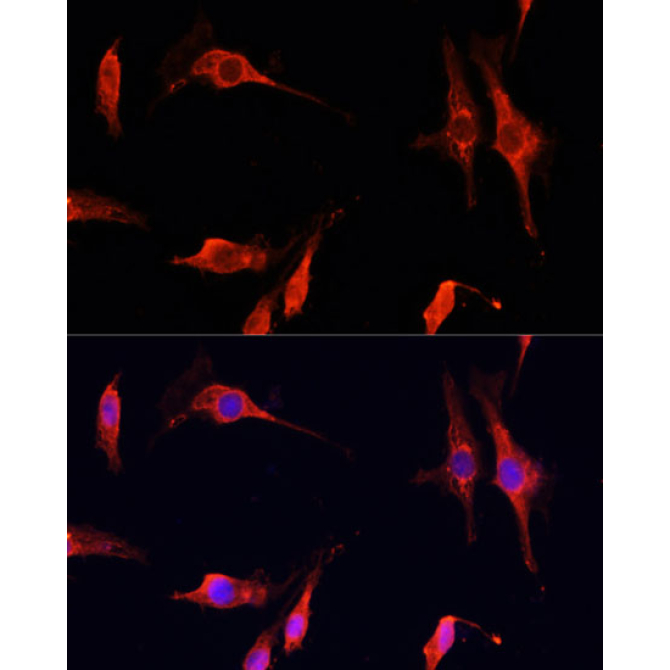 DNASE1 Rabbit Polyclonal Antibody