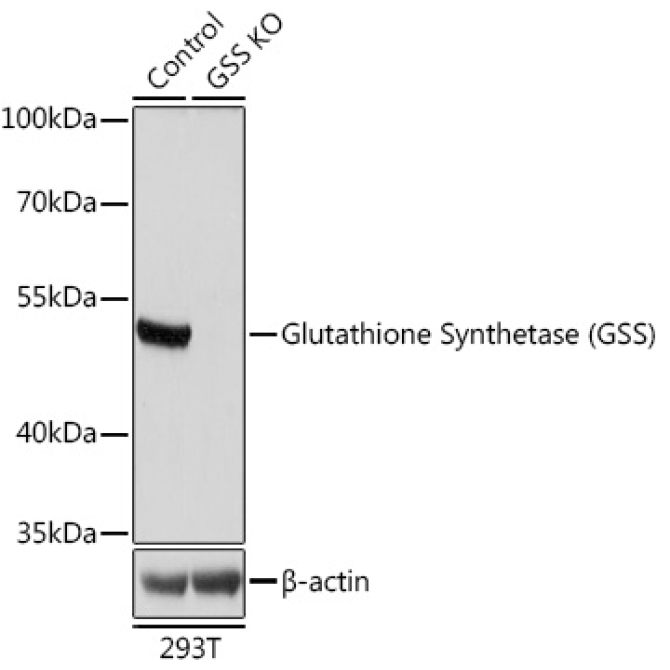 Glutathione Synthetase (GSS) Rabbit Polyclonal Antibody [KO Validated]