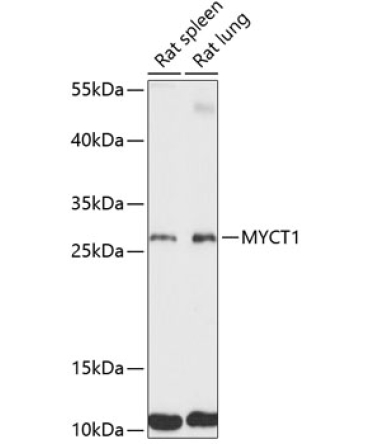 MYCT1 Rabbit Polyclonal Antibody
