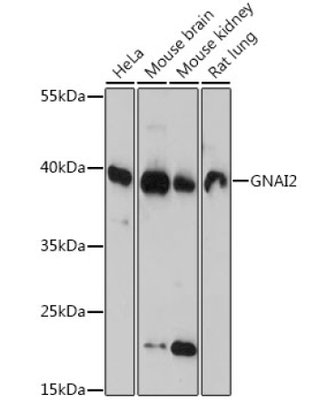 GNAI2 Rabbit Polyclonal Antibody