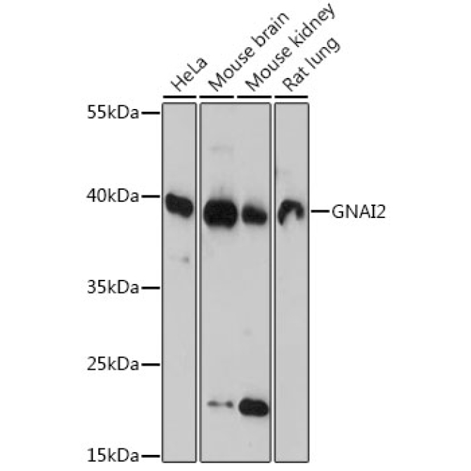 GNAI2 Rabbit Polyclonal Antibody