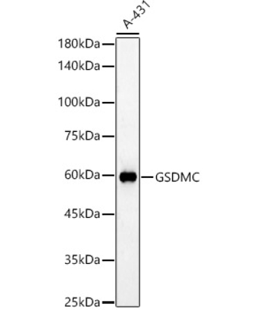 GSDMC Rabbit Polyclonal Antibody