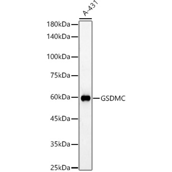 GSDMC Rabbit Polyclonal Antibody