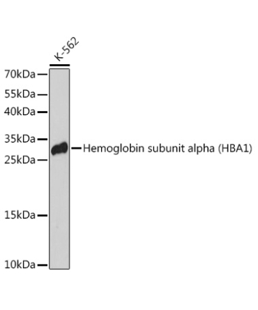 Hemoglobin subunit alpha (HBA1) Rabbit Polyclonal Antibody