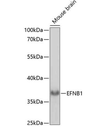 EFNB1 Rabbit Polyclonal Antibody