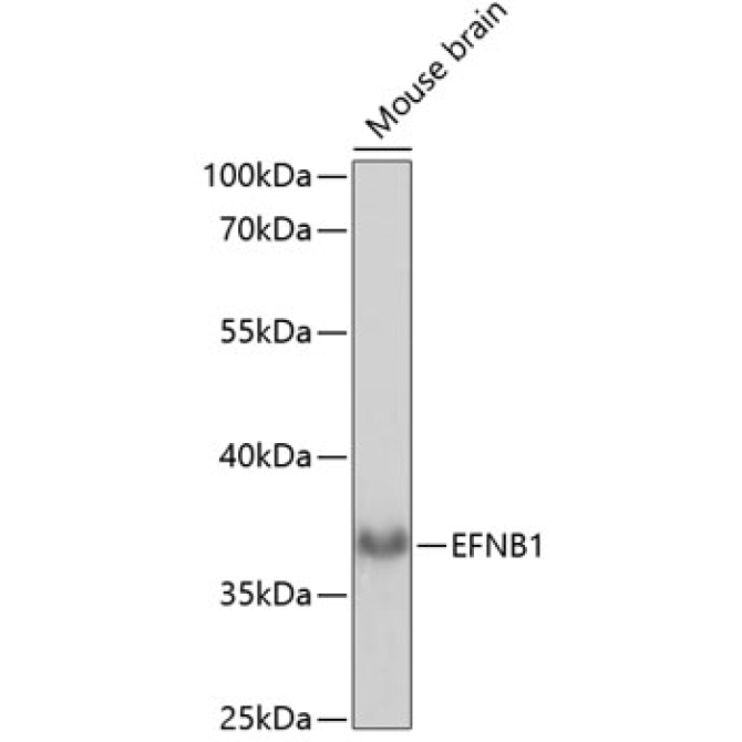 EFNB1 Rabbit Polyclonal Antibody