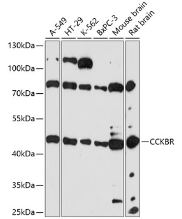 CCKBR Rabbit Polyclonal Antibody