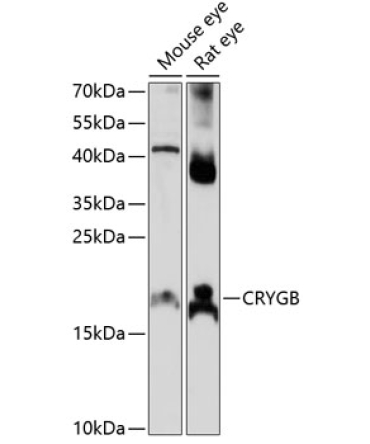 CRYGB Rabbit Polyclonal Antibody