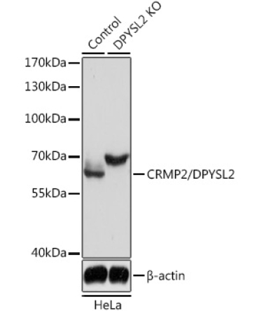 CRMP2/DPYSL2 Rabbit Polyclonal Antibody [KO Validated]