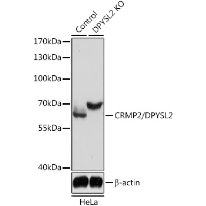 CRMP2/DPYSL2 Rabbit Polyclonal Antibody [KO Validated]