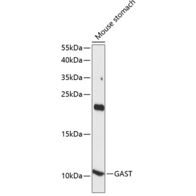 GAST Rabbit Polyclonal Antibody