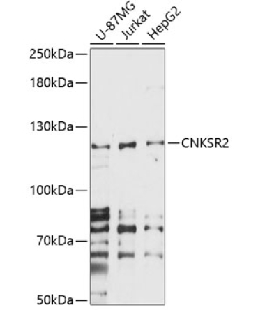 CNKSR2 Rabbit Polyclonal Antibody