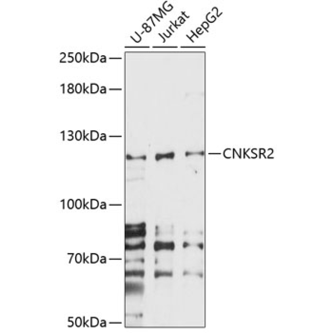 CNKSR2 Rabbit Polyclonal Antibody