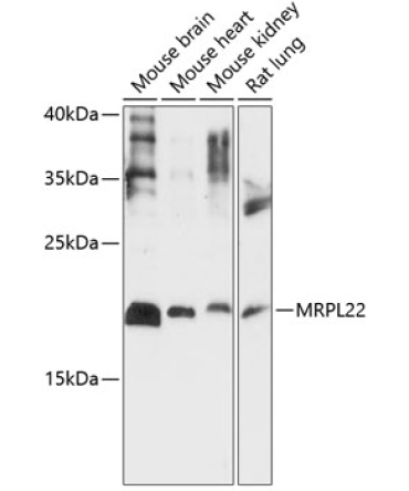 MRPL22 Rabbit Polyclonal Antibody