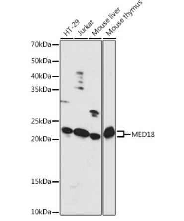 MED18 Rabbit Polyclonal Antibody