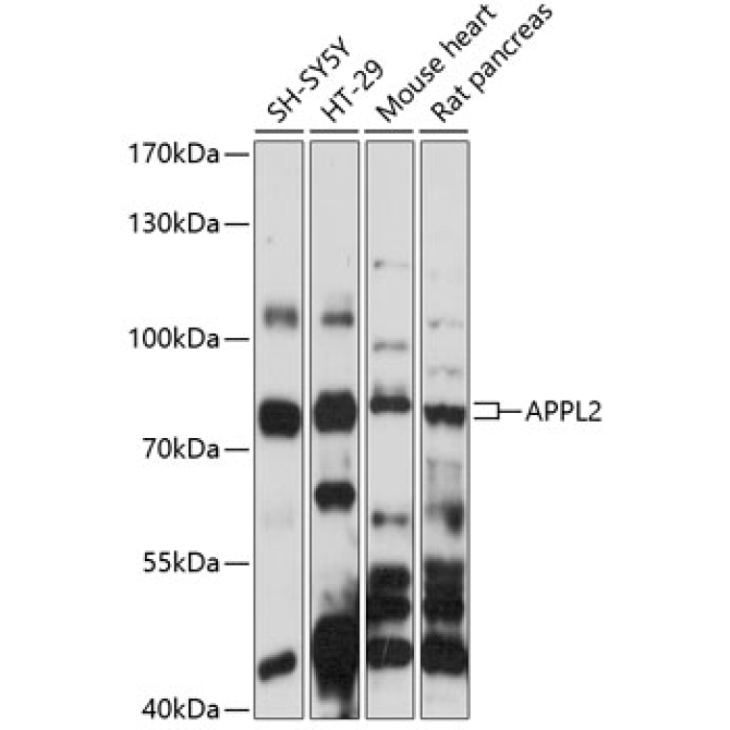 APPL2 Rabbit Polyclonal Antibody