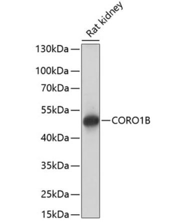 CORO1B Rabbit Polyclonal Antibody