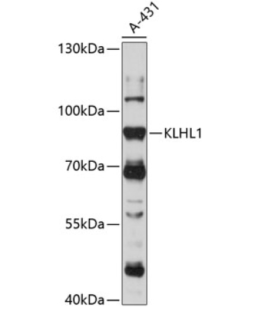 KLHL1 Rabbit Polyclonal Antibody