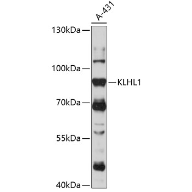 KLHL1 Rabbit Polyclonal Antibody