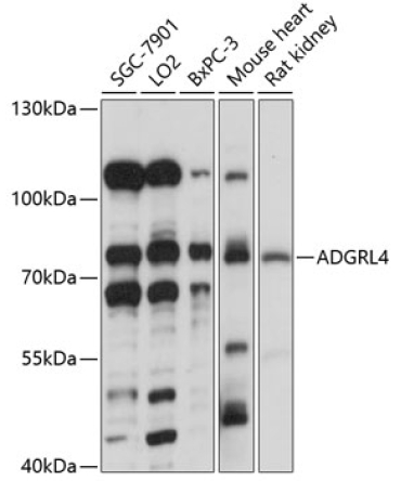 ADGRL4 Rabbit Polyclonal Antibody