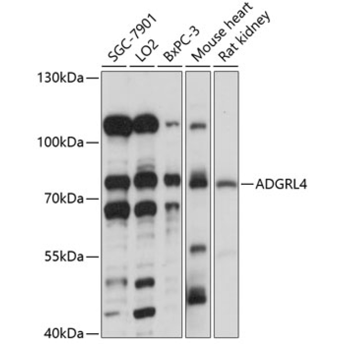 ADGRL4 Rabbit Polyclonal Antibody