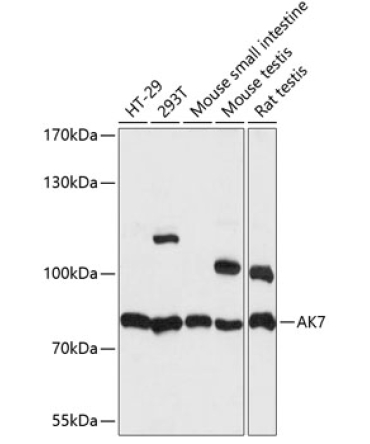 AK7 Rabbit Polyclonal Antibody