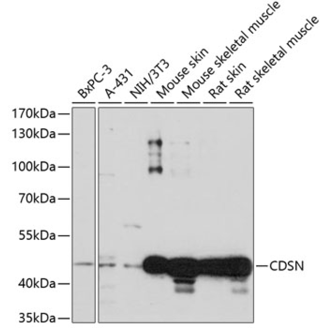 CDSN Rabbit Polyclonal Antibody