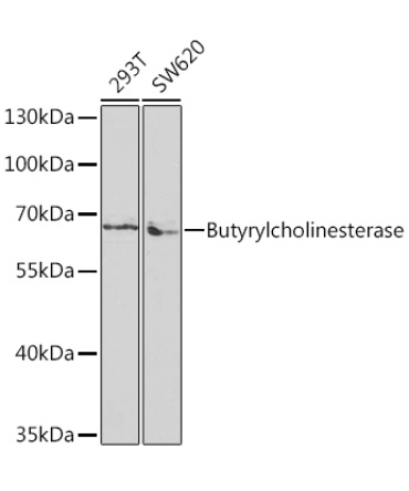 Butyrylcholinesterase Rabbit Polyclonal Antibody