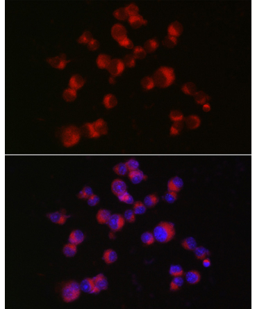 Doublecortin Rabbit Polyclonal Antibody
