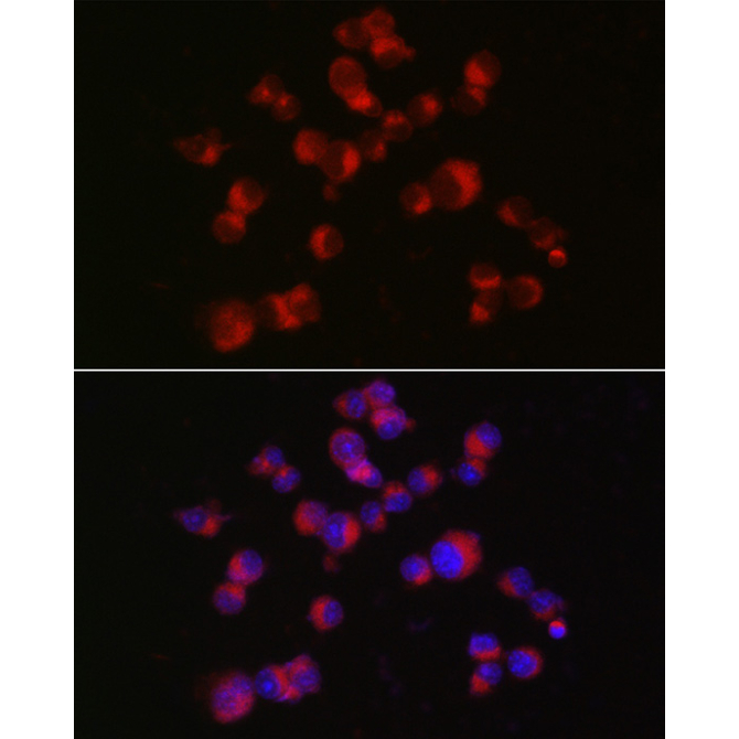 Doublecortin Rabbit Polyclonal Antibody