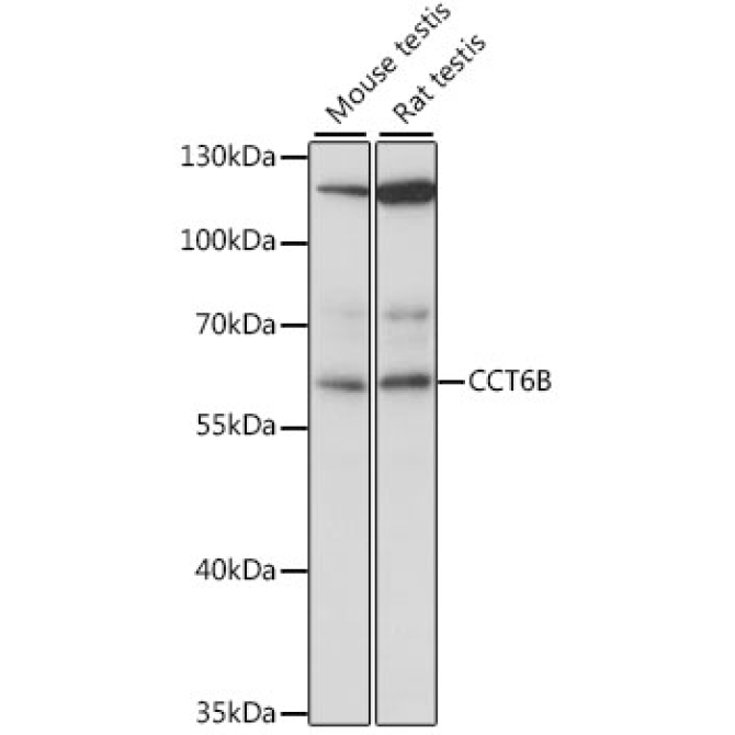 CCT6B Rabbit Polyclonal Antibody