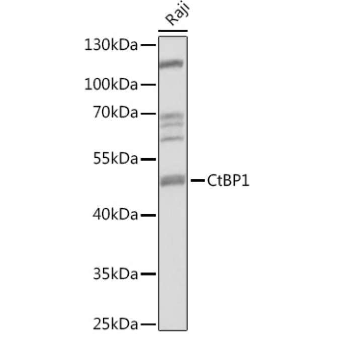 CtBP1 Rabbit Polyclonal Antibody
