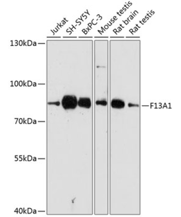F13A1 Rabbit Polyclonal Antibody
