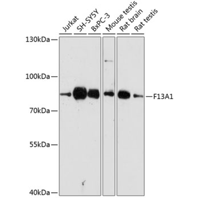 F13A1 Rabbit Polyclonal Antibody
