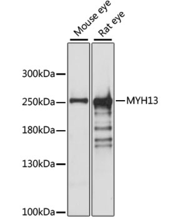 MYH13 Rabbit Polyclonal Antibody
