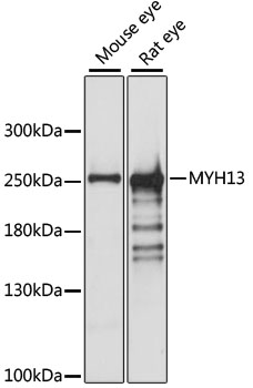 MYH13 Rabbit Polyclonal Antibody