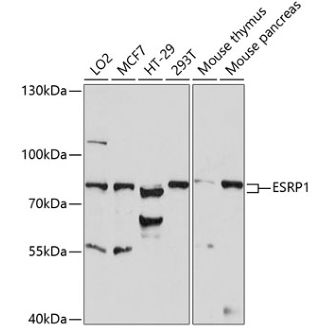 ESRP1 Rabbit Polyclonal Antibody