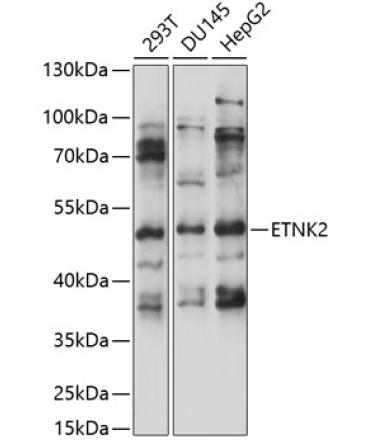 ETNK2 Rabbit Polyclonal Antibody