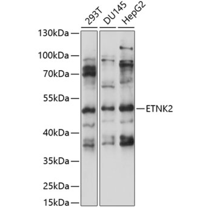ETNK2 Rabbit Polyclonal Antibody