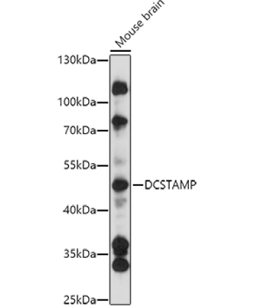 DCSTAMP Rabbit Polyclonal Antibody