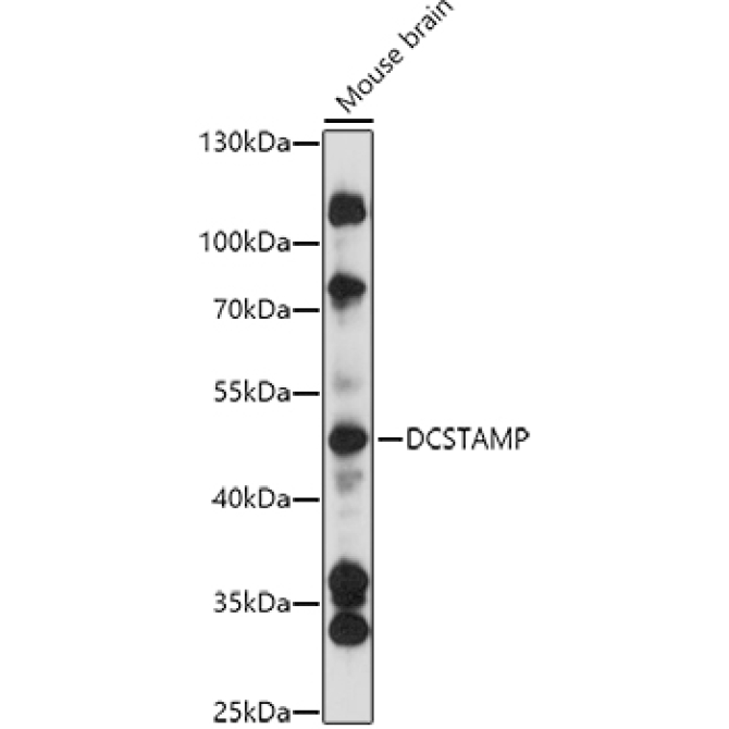 DCSTAMP Rabbit Polyclonal Antibody