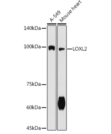 LOXL2 Rabbit Polyclonal Antibody