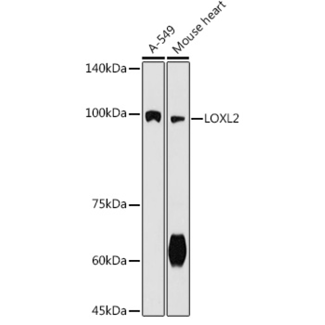 LOXL2 Rabbit Polyclonal Antibody