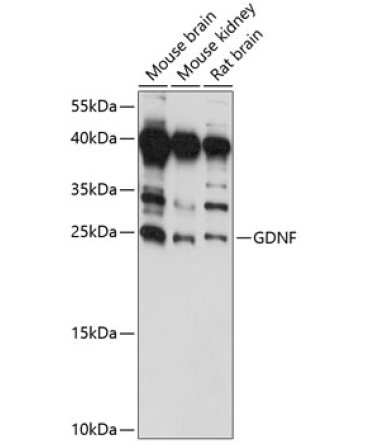 GDNF Rabbit Polyclonal Antibody