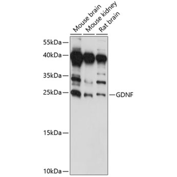 GDNF Rabbit Polyclonal Antibody