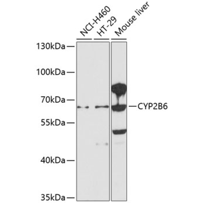 CYP2B6 Rabbit Polyclonal Antibody