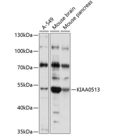 KIAA0513 Rabbit Polyclonal Antibody