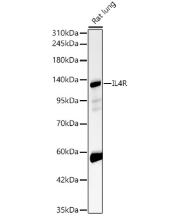 IL4R Rabbit Polyclonal Antibody