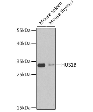 HUS1B Rabbit Polyclonal Antibody