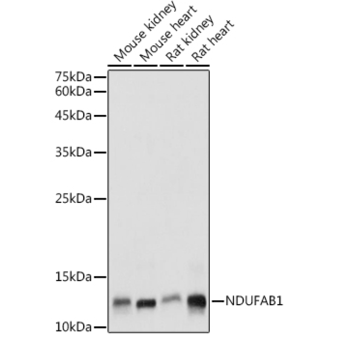 NDUFAB1 Rabbit Polyclonal Antibody
